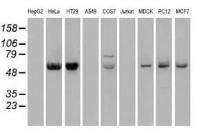 CHEK2 / CHK2 Antibody (clone OTI2F4)