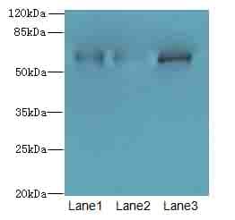 ZNF554 Antibody