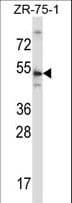 Polyclonal Rabbit anti-Human TERF2 / TRF2 Antibody (aa308-337, IHC, WB)