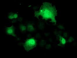 SMS / Spermine Synthase Antibody (clone OTI3A8, Carrier-free)
