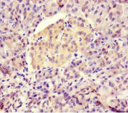 HSBLMHC1 / BTNL2 Antibody