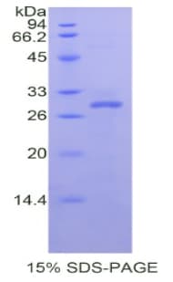 Human YWHAZ / 14-3-3 Zeta Protein (Recombinant His)