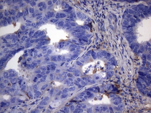 Monoclonal Mouse anti-Human CRP / C-Reactive Protein Antibody (clone OTI7C10, IHC, WB)