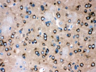 ROCK2 Antibody