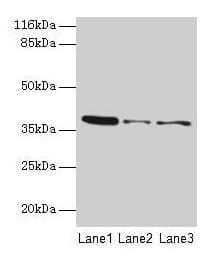 MAS1 / MAS Antibody (aa285-352)