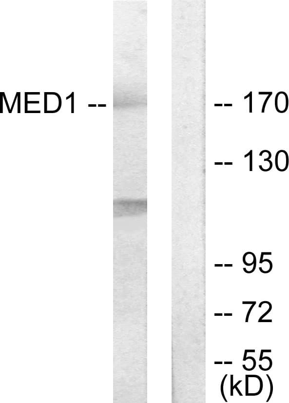 MED1 / TRAP220 Antibody (aa641-690)