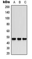 JUN / c-Jun Antibody (phospho-Ser73/100)