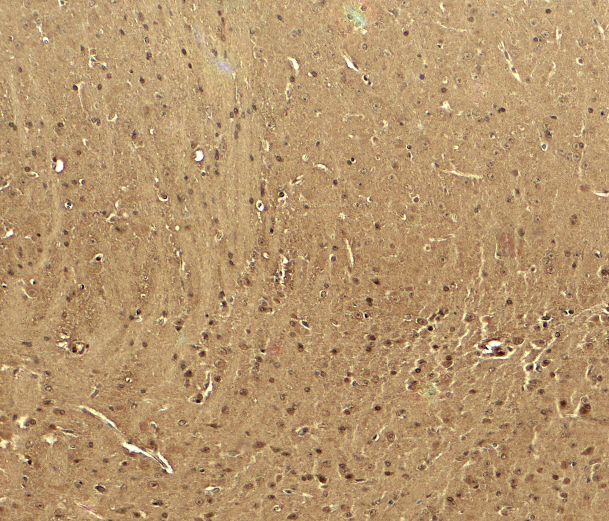 IHC-plus™ CACNA1H / Cav3.2 Antibody