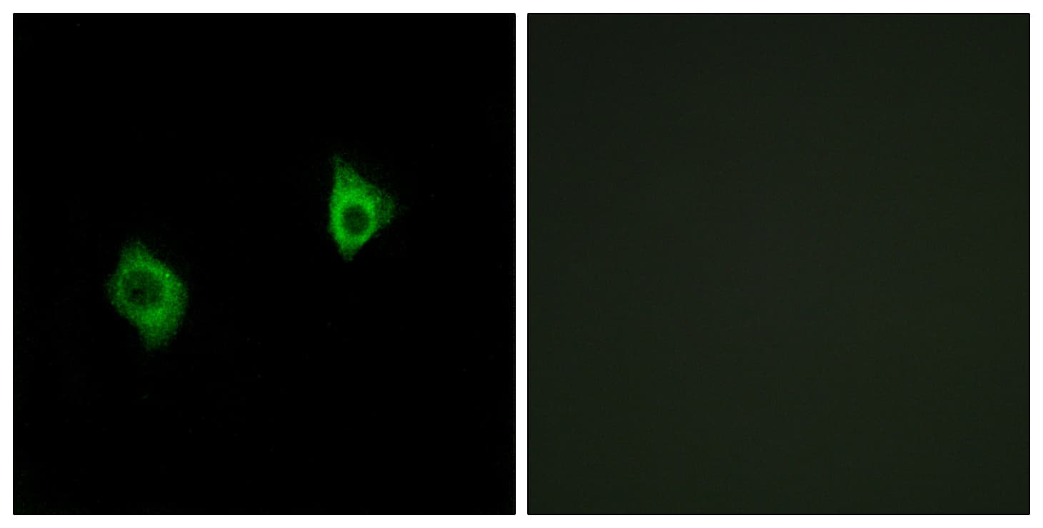 RPS9 / Ribosomal Protein S9 Antibody (aa31-80)