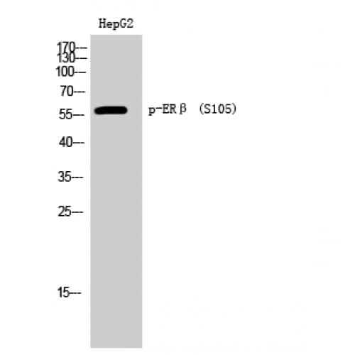 Polyclonal Rabbit anti-Human ESR2 / ER Beta Antibody (40-120 aa, IF, WB)