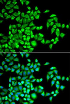 Polyclonal Rabbit anti-Human ALKBH1 / ALKB Antibody (IF, WB)