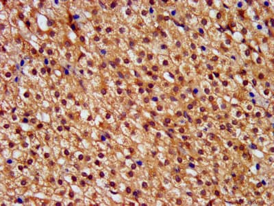 PNPLA8 Antibody