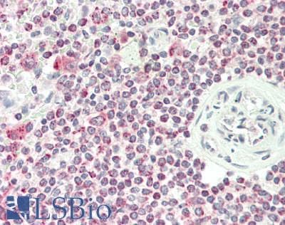 IHC-plus™ CHRNA10 Antibody (aa179-206)