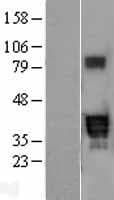 Human PPT2 Protein (Over-Expression Lysate Myc-DDK (Flag))
