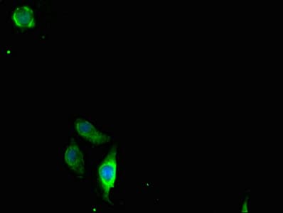CLDN2 / Claudin 2 Antibody (aa30-230)