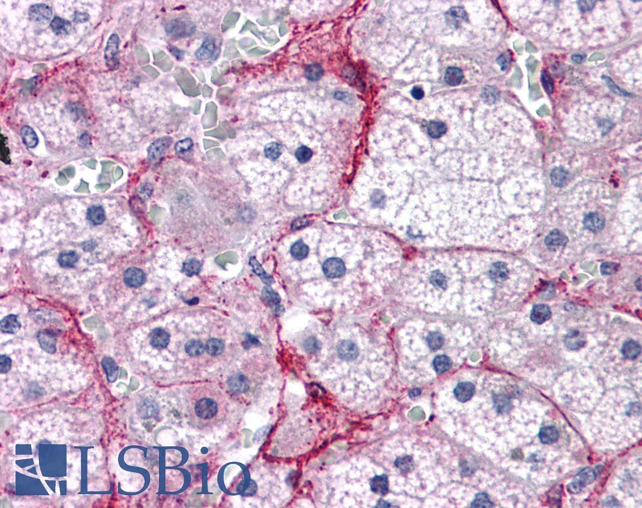 IHC-plus™ TBC1D4 / AS160 Antibody