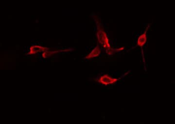 RAIG2 / GPRC5B Antibody