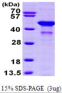 Human GLUL / Glutamine Synthetase Protein (Recombinant His)