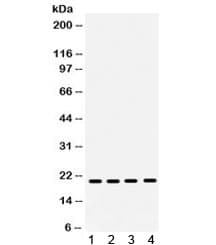 Polyclonal Rabbit anti-Human NME1 / NM23 Antibody (WB)