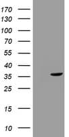 TS / Thymidylate Synthase Antibody (clone OTI2C5)