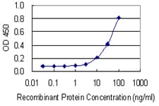 IHC-plus™ SHBG Antibody (clone 5E6)