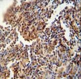 HFM1 Antibody (aa1293-1321)