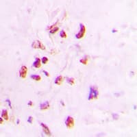 XRCC3 Antibody (Internal)