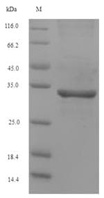 Ascaris suum PI-3 Protein (Recombinant 6His-SUMO, N-terminus)