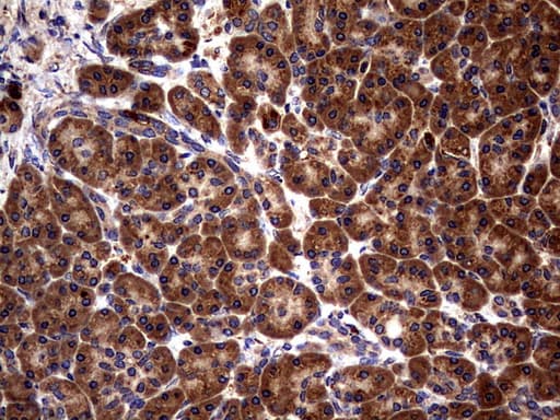 Monoclonal Mouse anti-Human GBA / Glucosidase Beta Acid Antibody (clone OTI4G4, aa40-315, IHC, WB)