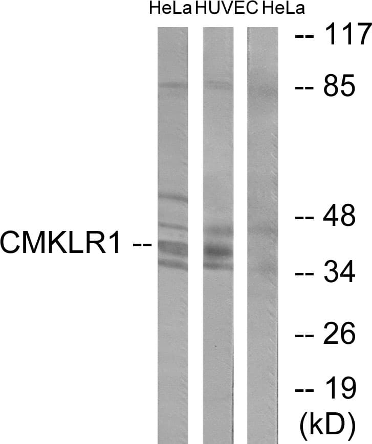 CHEMR23 / CMKLR1 Antibody (aa221-270)