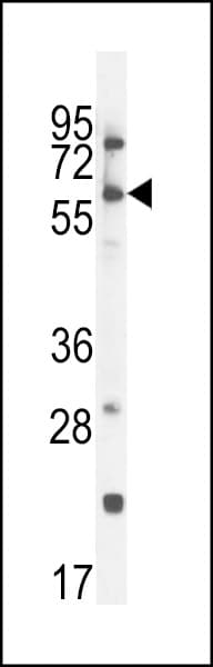 CCDC148 Antibody (aa279-307)