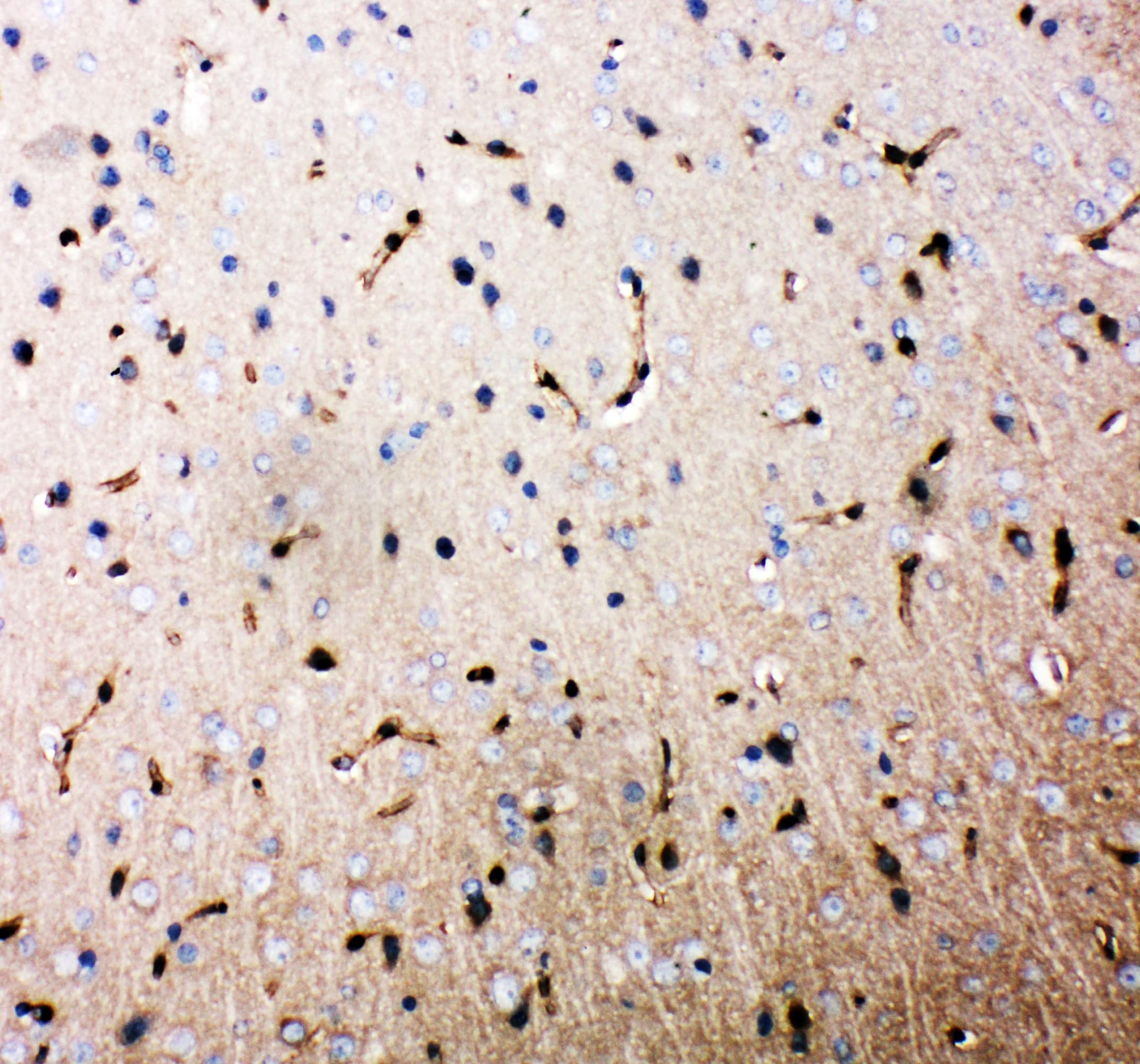 Polyclonal Rabbit anti-Human AQP4 / Aquaporin 4 Antibody (aa258-274, IHC, WB)