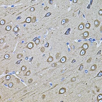 MAP1B Antibody