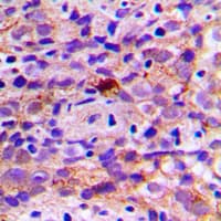 CES2 / Esterase Antibody (Internal)