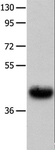 Polyclonal Rabbit anti-Human UTS2R / GPR14 Antibody (WB)