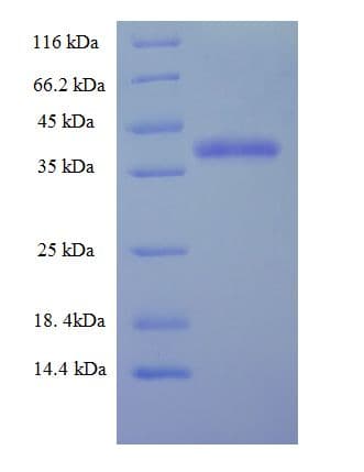 Human Vps60 / CHMP5 Protein (Recombinant His-SUMO)
