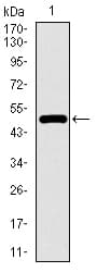 TP53BP1 / 53BP1 Antibody (aa574-773, clone 6B3E10)