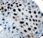 Recombinant Monoclonal Rabbit anti-Human TOP2A / Topoisomerase II Alpha Antibody (clone RBT-Topo 2a, Ready-to-Use, IHC)