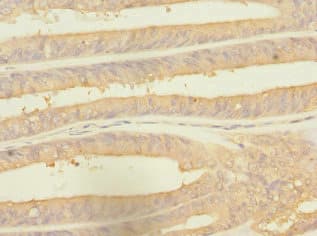 Polyclonal Rabbit anti-Human RPS27 / Ribosomal Protein S27 Antibody (IHC, WB)