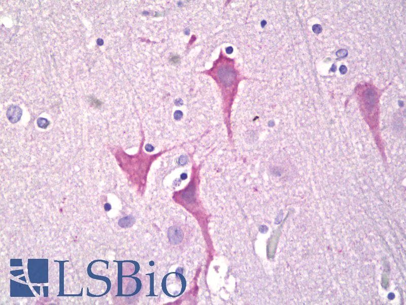 IHC-plus™ PRKD1 / PKC Mu Antibody (aa171-220)