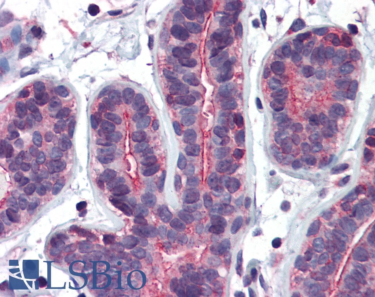 IHC-plus™ RHOA Antibody (clone 1C1)