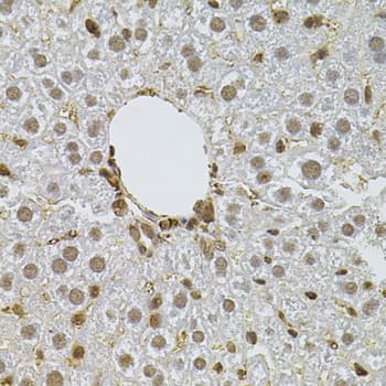 Polyclonal Rabbit anti-Human PPP2R5C Antibody (IHC, WB)
