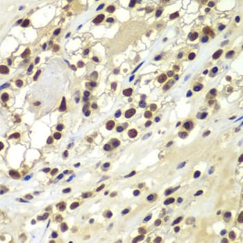 Polyclonal Rabbit anti-Human PRKDC / DNA-PKcs Antibody (IHC, WB)