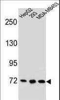 ZNF860 Antibody (aa601-629)
