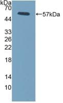 FCGR3A / CD16A Antibody (aa5-240)