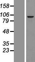 RSPH10B Protein (Over-Expression Lysate Myc-DDK (Flag))