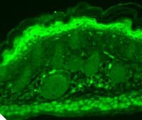 TRPV3 Antibody (aa458-474, clone S15-4)