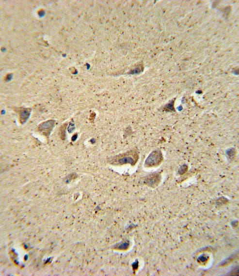 SCN1B Antibody (aa63-90)