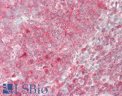 IHC-plus™ INPP5D / SHIP1 / SHIP Antibody (N-Terminus, clone SHIP-01)