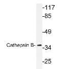 Polyclonal Rabbit anti-Human CTSB / Cathepsin B Antibody (aa200-270, IHC, IF, WB)